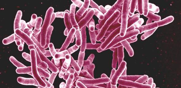 Mycobacterium tuberculosis