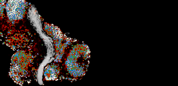 Brain of a frog embryo. The coloured structures are cell nuclei (containing DNA), the white structure in the center corresponds to the optic tract, which contains the neuronal axons studied., Credit: Eva Pillai