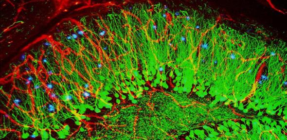 Brain showing hallmarks of Alzheimer's disease (cropped), Credit: ZEISS Microscopy
