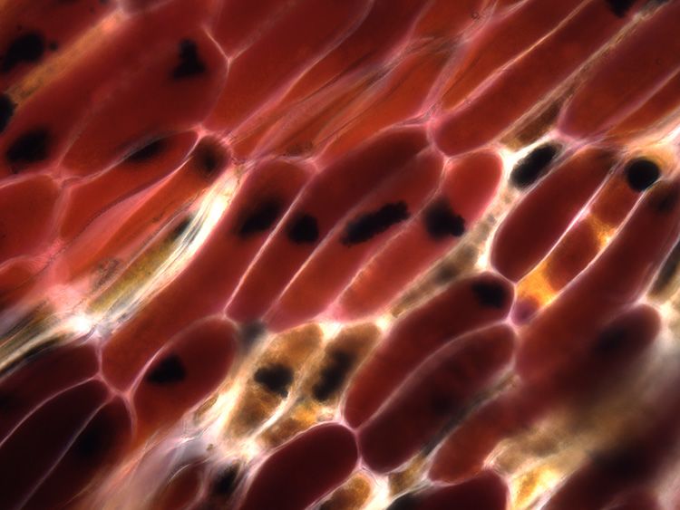 Microscope image of pigment accumulation in fake fly spot.