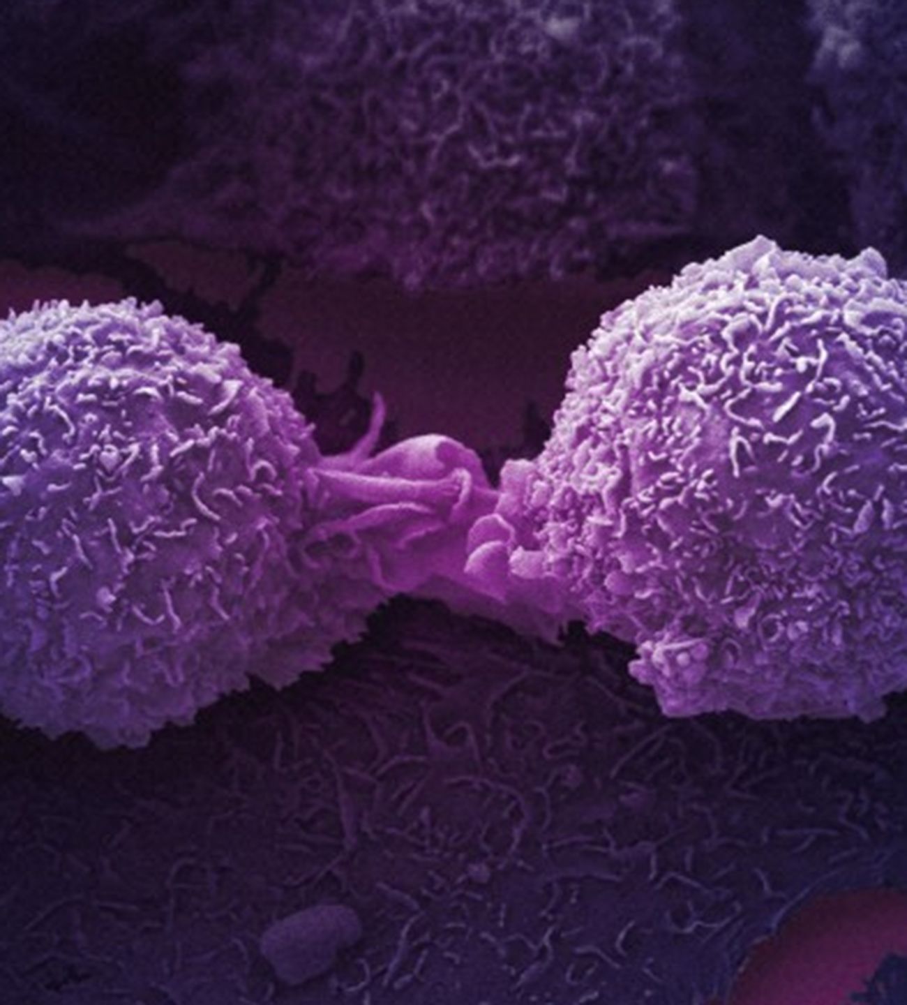 cancer cells