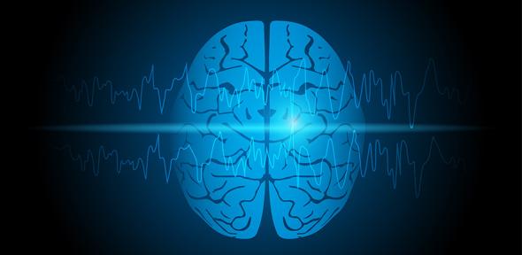 Visual representation of focal epilepsy