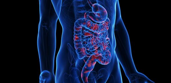 Artist's impression of Crohn's disease
