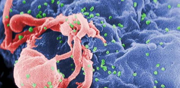 HIV-1 budding from a cultured cell