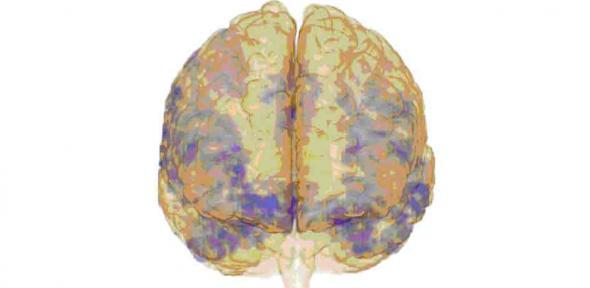 Brain
