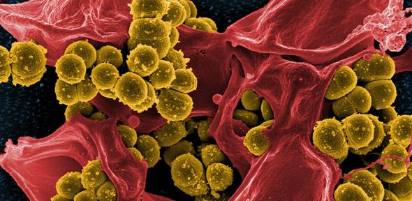 Micrograph of Methicillin-Resistant Staphylococcus aureus (MRSA)