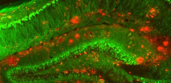 Mouse model of Alzheimer's disease
