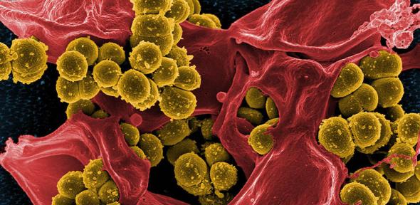 Scanning electron micrograph of MRSA