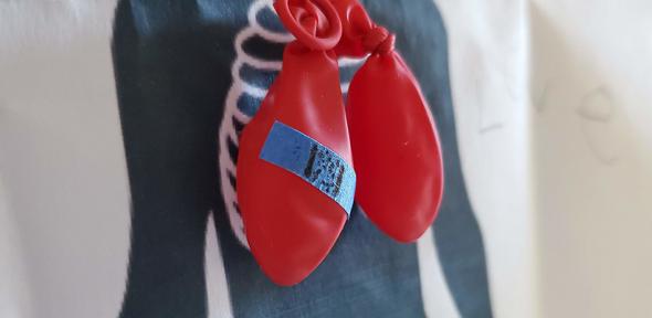 Deflated balloons representing punctured lung after COVID-19 infection