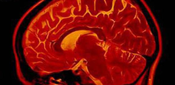 Brain scan
