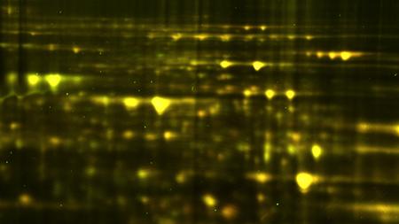 Gel electrophoresis