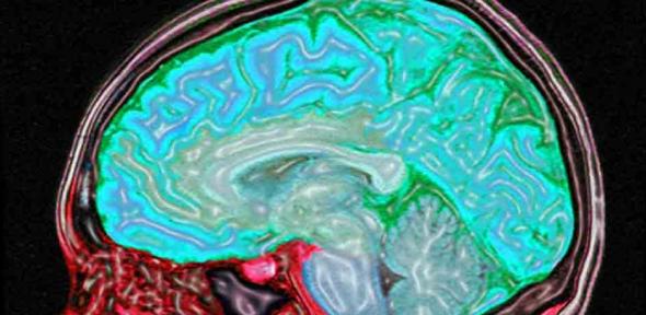 Digitally enhanced MRI of the human head showing the brain and spinal cord in blue/green and the other tissues in red and pink.