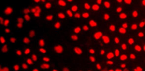 Differentiation of human Induced Pluripotent Stem Cells (hIPSC) to functional liver hepatocyte cells