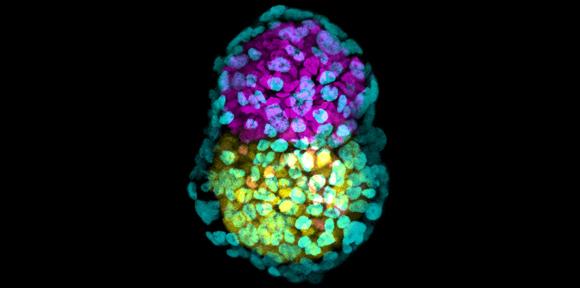 Synthetic embryo-like structure made of three stem cells types in yellow, pink and green