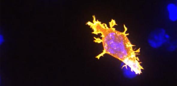 Killer T-cell