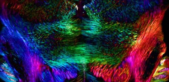 Spatially oriented neurons (mouse brain)