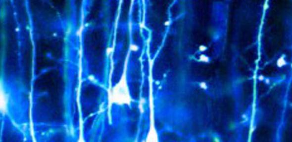 parkinsons neurons