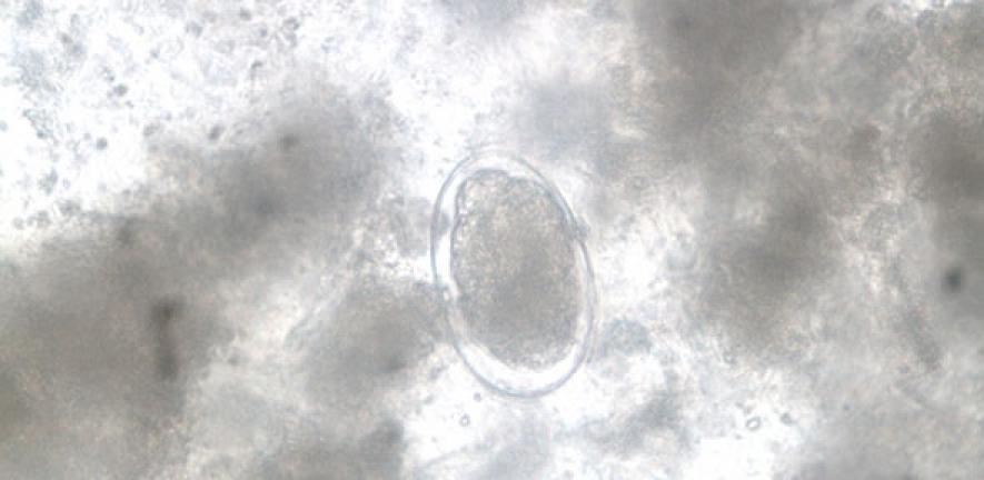 Hookworm x40mag (1)UK NEQAS