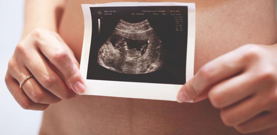 Pregnant