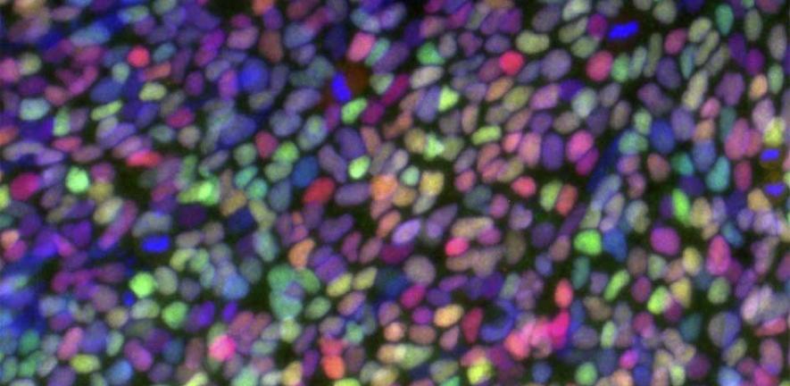 Stem cells