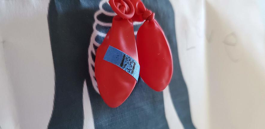 Deflated balloons representing punctured lung after COVID-19 infection
