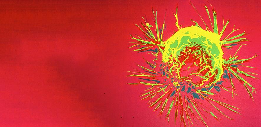 Breast Cancer Cell