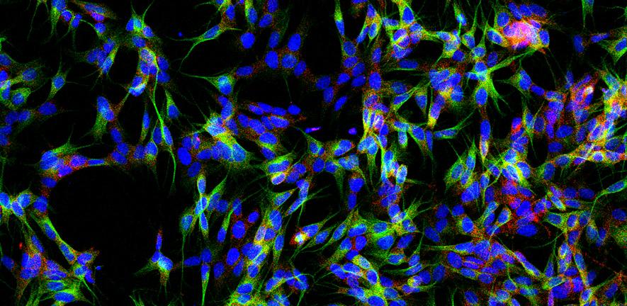 Drug target in neurons