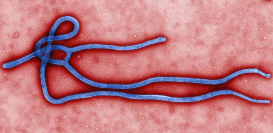 Ebola virus