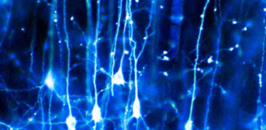 parkinsons neurons