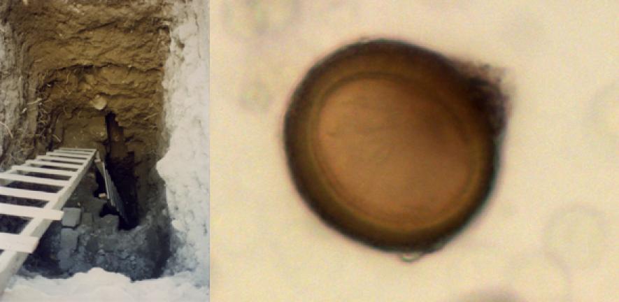 Right: excavation deep down into the latrine by the Ecole Biblique de Jerusalem. Left: Taenia tapeworm egg in the latrine indicating either pork or beef tapeworm. 