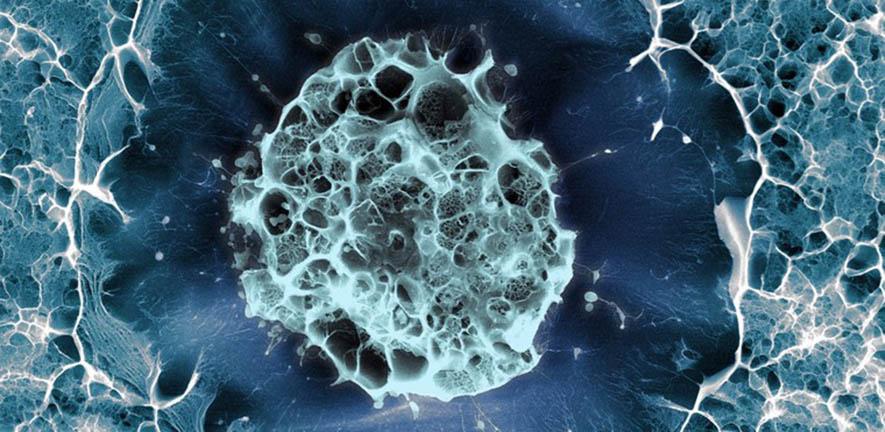 Human stem cell embedded in a 3D matrix, Cryo SEM