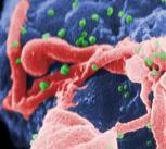 HIV-1 budding from a cultured cell