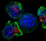 Killer T cells surround a cancer cell