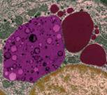 Molecular sacs of debris (pink) are delivered to the lysosome (dark red)