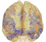 Brain