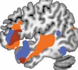 Functional neuroimaging of the human brain