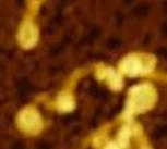 Detail of an atomic force microscopy image which shows amyloid fibrils of alpha-synuclein grown out of synthetic lipid vesicles 