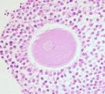 Ovum in Cumulus Oophorus, Human Ovary
