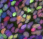 Stem cells