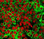 Human Colon Cancer Cells