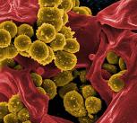 Scanning electron micrograph of MRSA