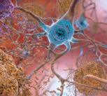 Beta-Amyloid Plaques and Tau in the Brain
