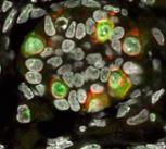 Developing human primordial germ cells (each small green and red cell is a PGC)
