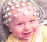 Babies wearing 'head cap' to measure electrical brain activity