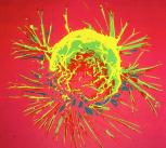 Breast Cancer Cell