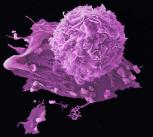 Breast cancer cells