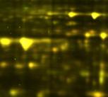 Gel electrophoresis