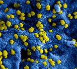 Close-up of virus molecule
