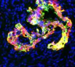 Pre-cancerous pancreatic tissue in mice