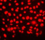 Differentiation of human Induced Pluripotent Stem Cells (hIPSC) to functional liver hepatocyte cells